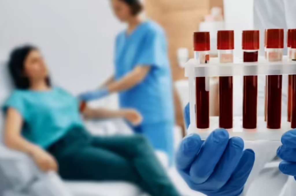 How Lifestyle Choices Impact Your Blood Test Results