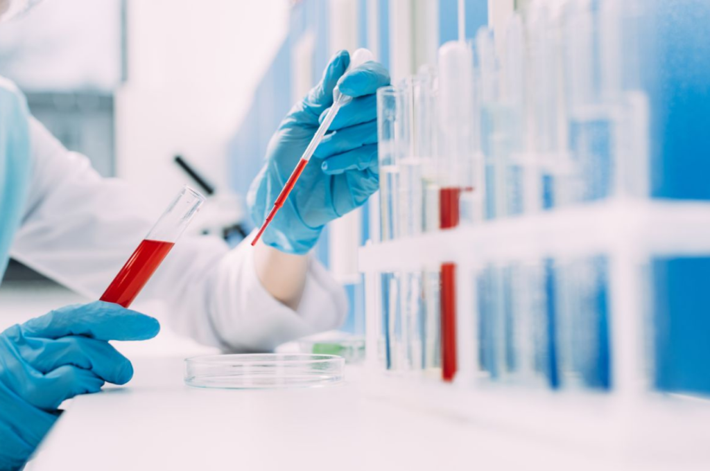 The Importance of Regular Blood Tests for Preventive Health